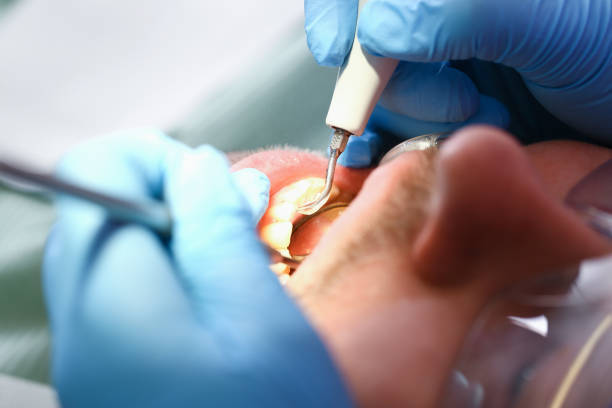 Best Emergency Pediatric Dental Care in Poplar Cotton Center, CA