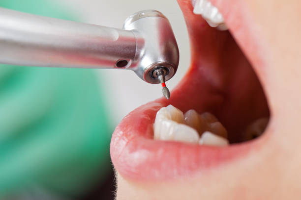 Best Emergency Care for Gum Disease in Poplar Cotton Center, CA